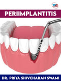 PERIIMPLANTITIS