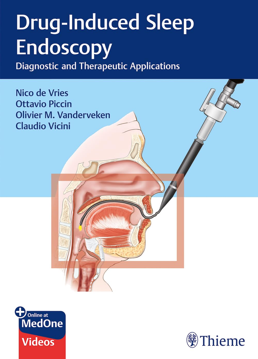DrugInduced Sleep Endoscopy: Diagnostic and Therapeutic Applications