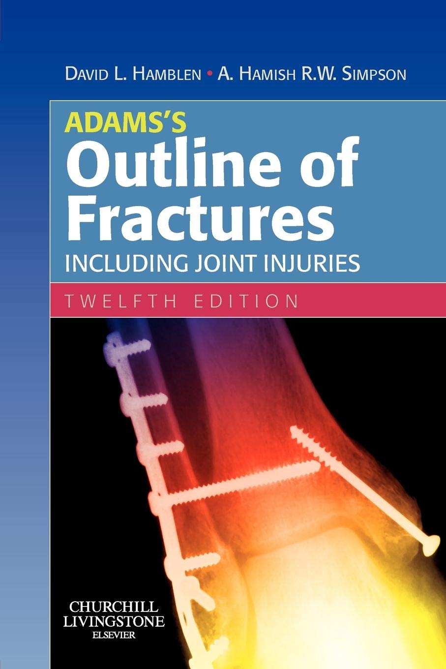 Adamss Outline of Fractures: Including Joint Injuries