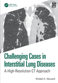 Challenging Cases in Interstitial Lung Diseases: A Highresolution Ct Approach