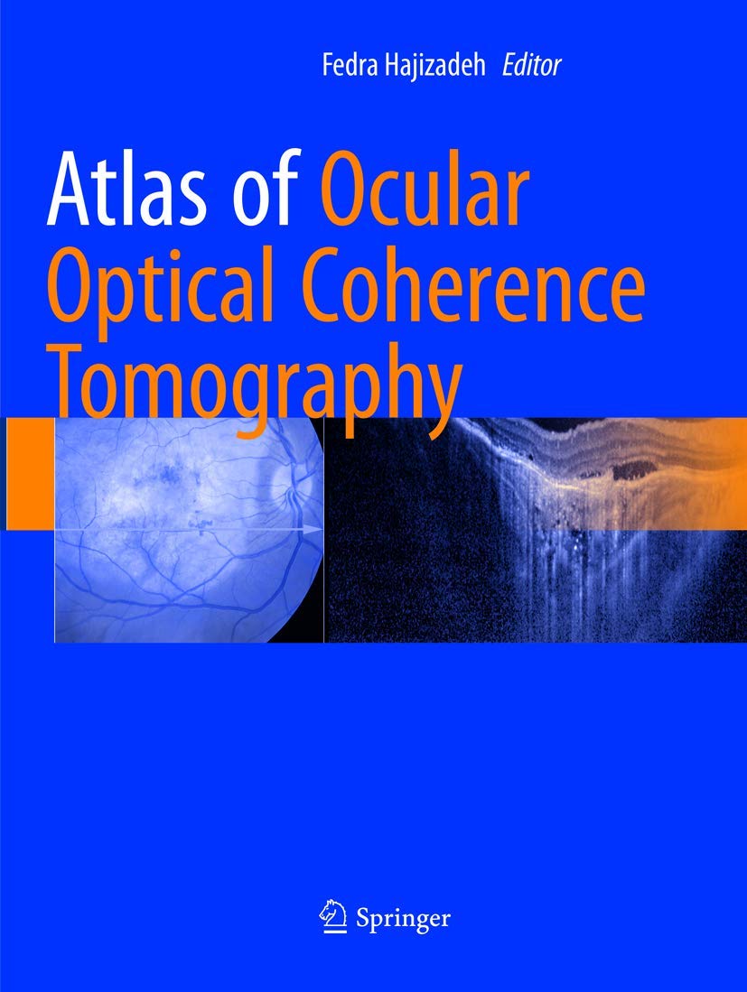 ATLAS OF OCULAR OPTICAL COHERENCE TOMOGRAPHY (PB 2019)