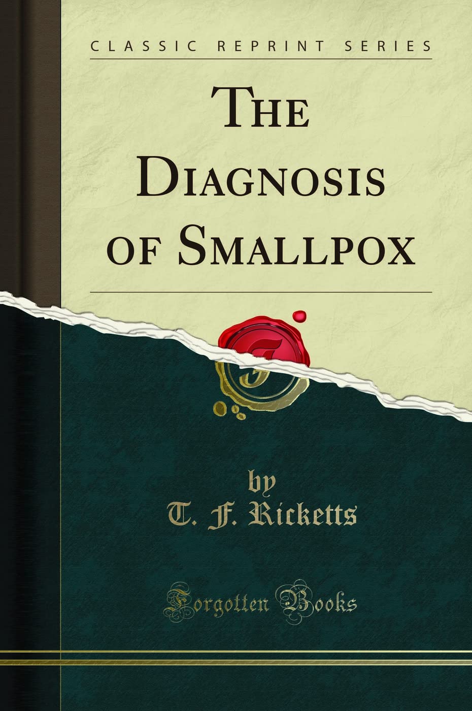 The Diagnosis Of Smallpox (Classic Reprint)