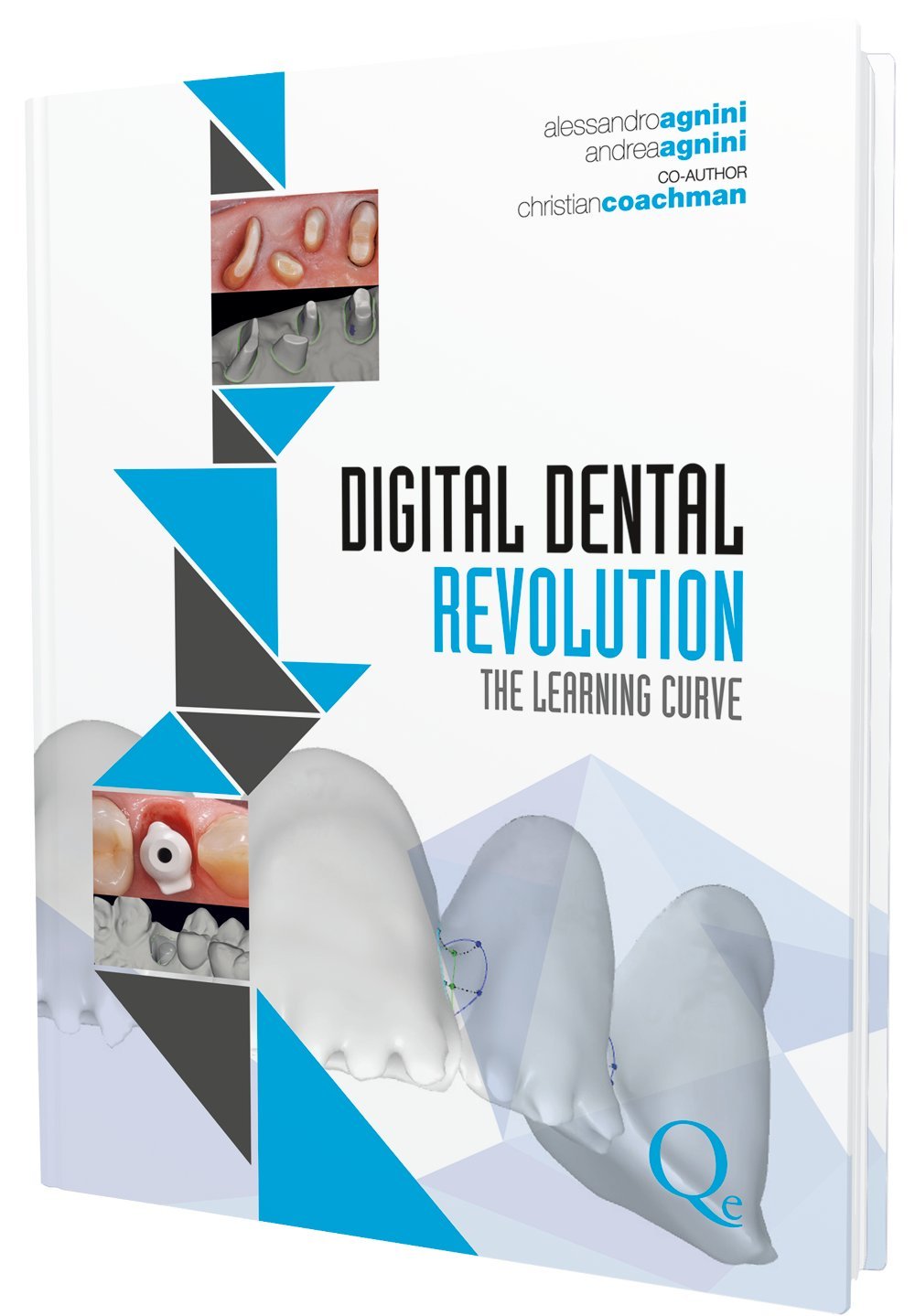 DIGITAL DENTAL REVOLUTION THE LEARNING CURVE WITH DVD (HB 2015)