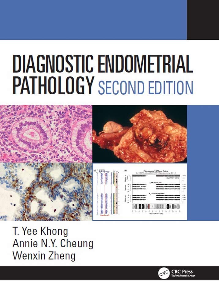 Diagnostic Endometrial Pathology 2E