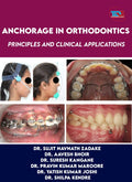 ANCHORAGE IN ORTHODONTICS PRINCIPLES AND CLINICAL APPLICATIONS
