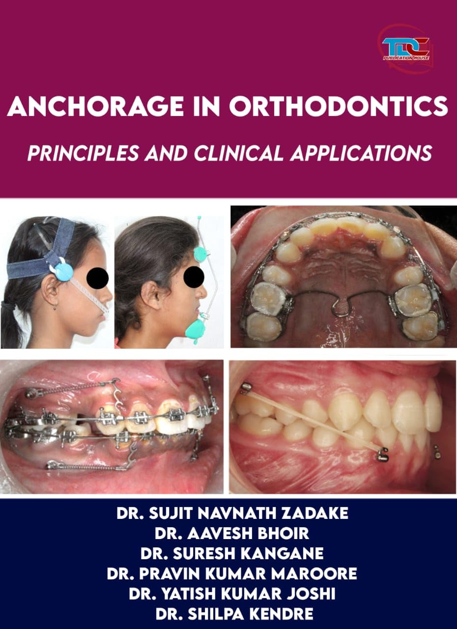 ANCHORAGE IN ORTHODONTICS PRINCIPLES AND CLINICAL APPLICATIONS