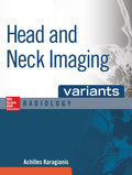 Head and Neck Imaging Variants
