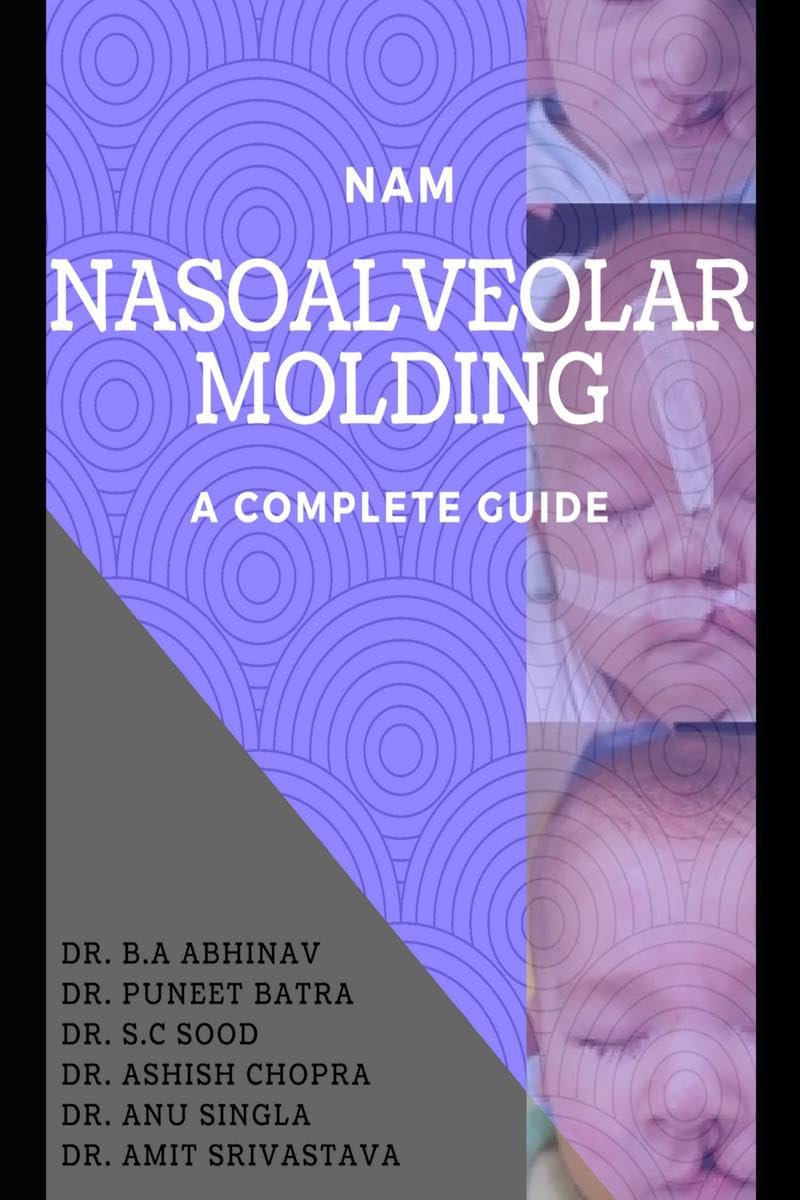 Nasoalveolar Molding A Complete Guide : A Detailed Overview Of Nam