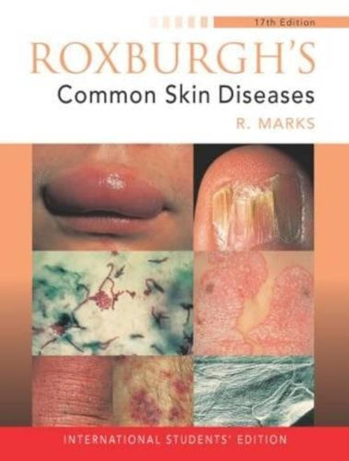 (Ex)(Old)RoxburghS Common Skin Diseases