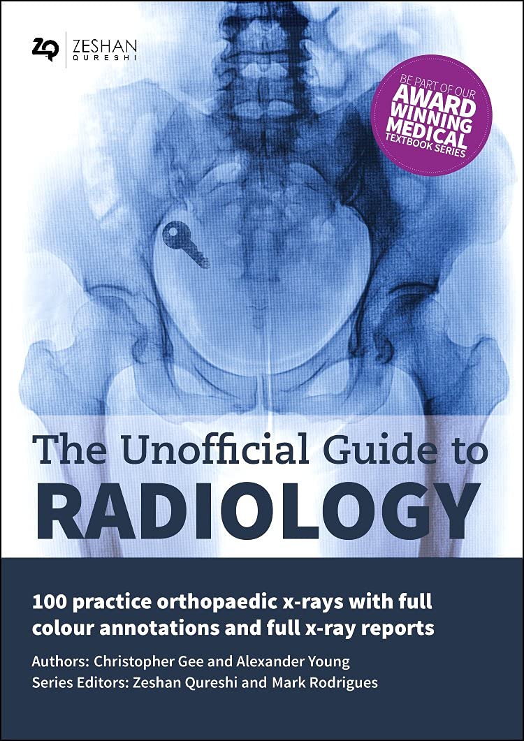 The Unofficial Guide To Radiology: 100 Practice Orthopaedic X Rays With Full Colour Annotations And Full X Ray Reports