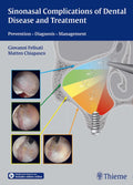 Sinonasal Complications of Dental Disease and Treatment: Prevention  Diagnosis  Management