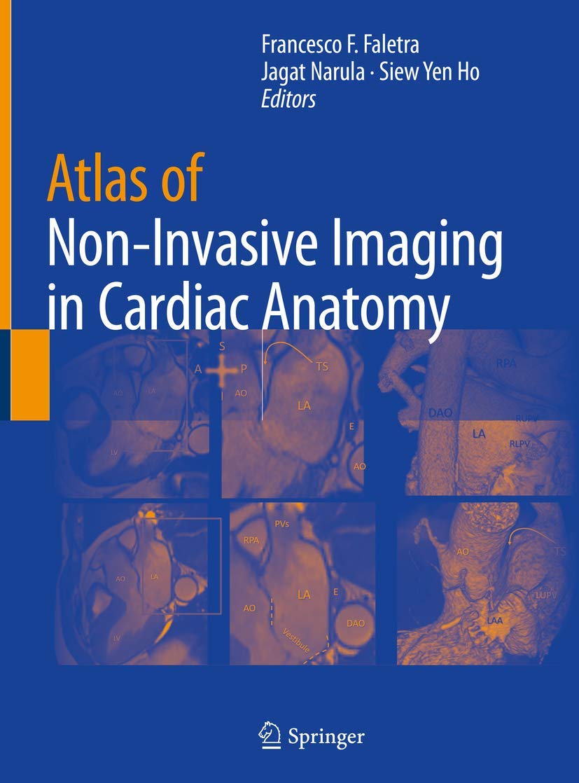 Atlas of NonInvasive Imaging in Cardiac Anatomy