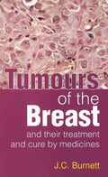 Tumours of the Breast  Their Treatment and Cure by Medicines