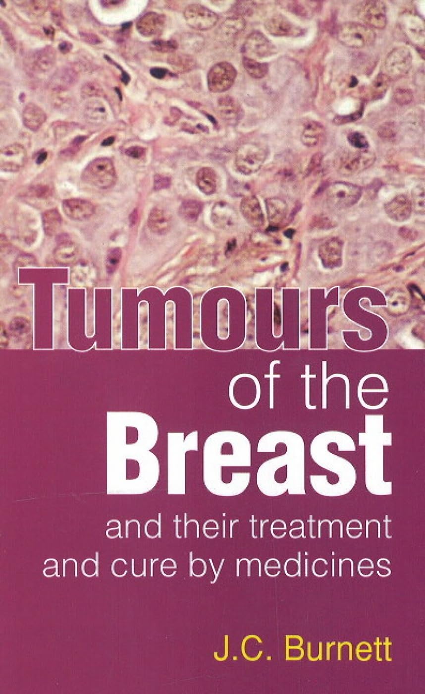 Tumours of the Breast  Their Treatment and Cure by Medicines