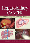 HEPATOBILIARY CANCER (AGENCY/DISTRIBUTED)
