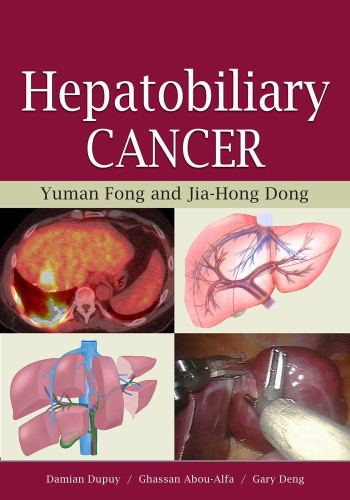 HEPATOBILIARY CANCER (AGENCY/DISTRIBUTED)