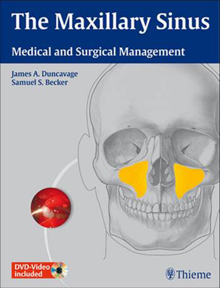 The Maxillary Sinus: Medical and Surgical Management