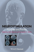 Neurostimulation: Principles and Practice