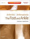 ARTHRITIS AND ARTHROPLASTY: THE FOOT AND ANKLE: EXPERT CONSULT  ONLINE, PRINT AND DVD