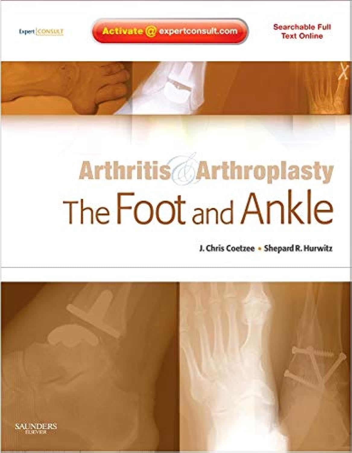 ARTHRITIS AND ARTHROPLASTY: THE FOOT AND ANKLE: EXPERT CONSULT  ONLINE, PRINT AND DVD