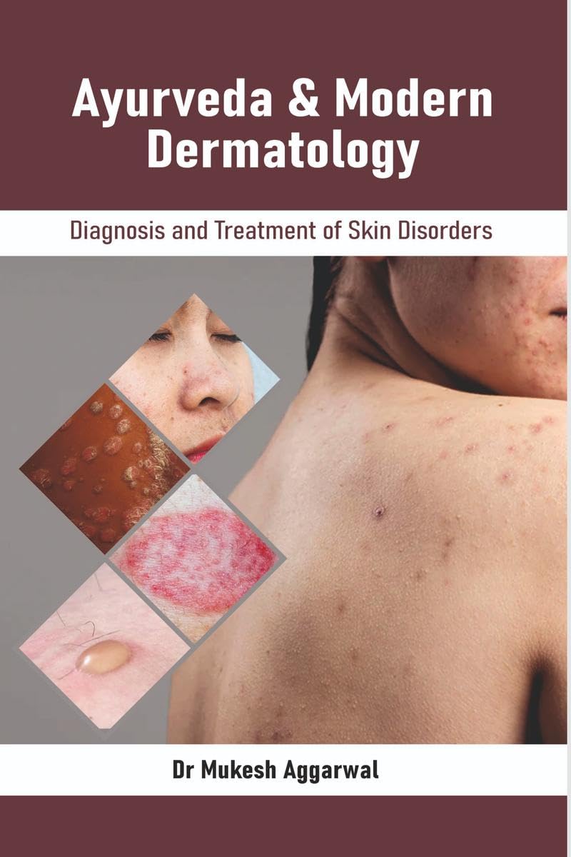 Ayurveda & Modern Dermatology : Diagnosis and Treatment of Skin Disorders