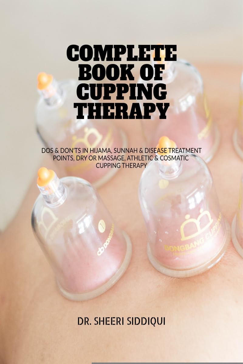 COMPLETE BOOK OF CUPPING THERAPY : DOS & DONTS IN HIJAMA, SUNNAH & DISEASE TREATMENT POINTS, DRY OR MASSAGE, ATHLETIC & COSMAT
