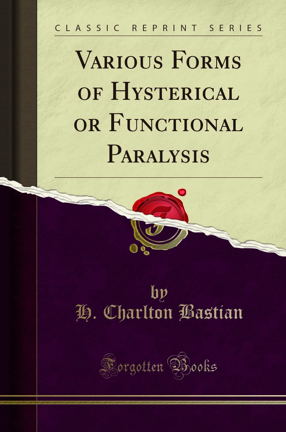 Various Forms of Hysterical or Functional Paralysis (Classic Reprint)