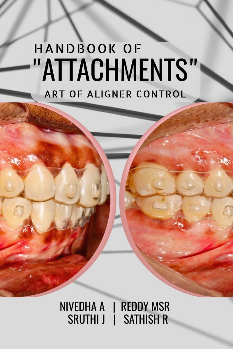 HANDBOOK OF ATTACHMENTS: ART OF ALIGNER CONTROL
