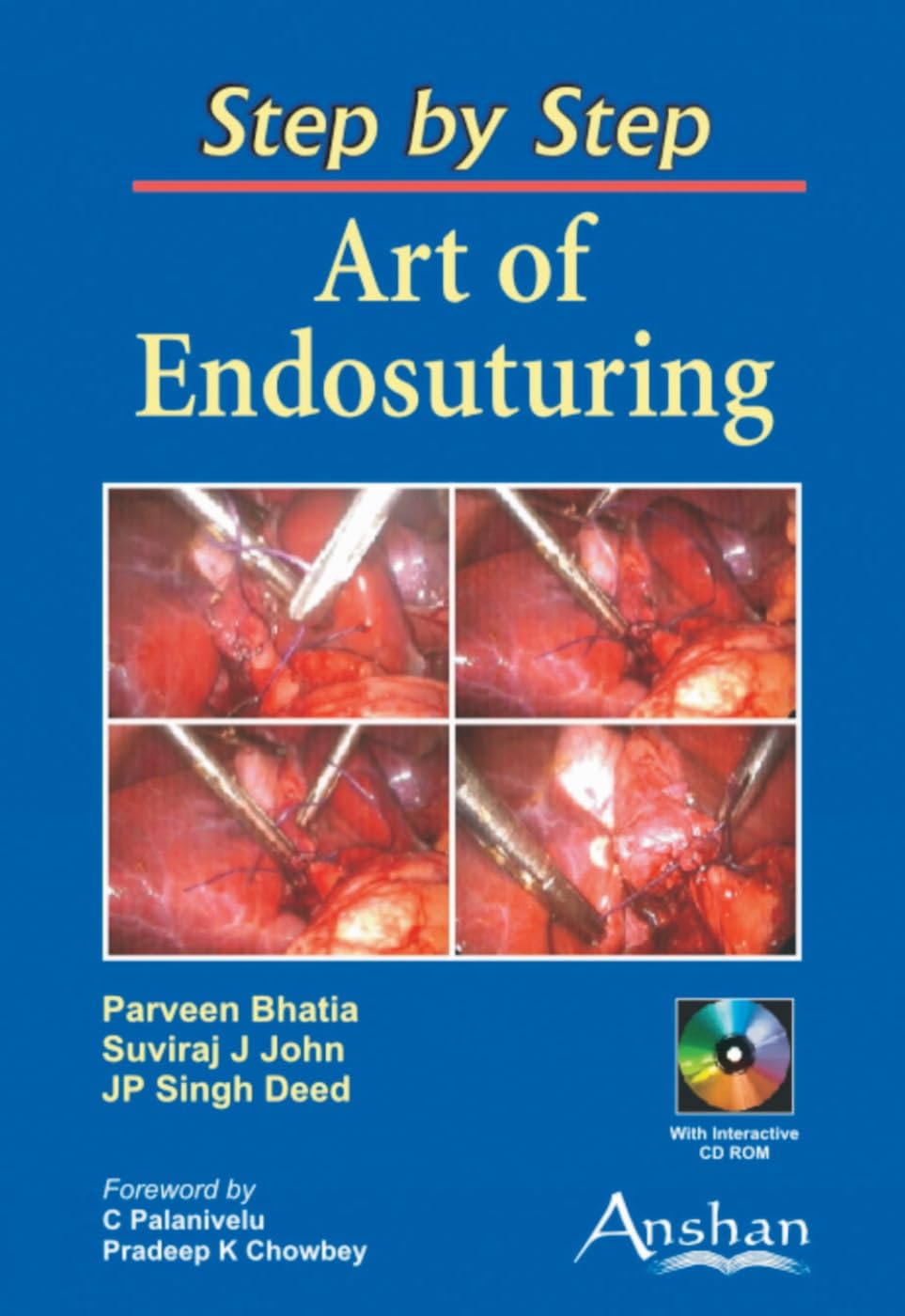 Step By Step Art Of Endosutuing Pb