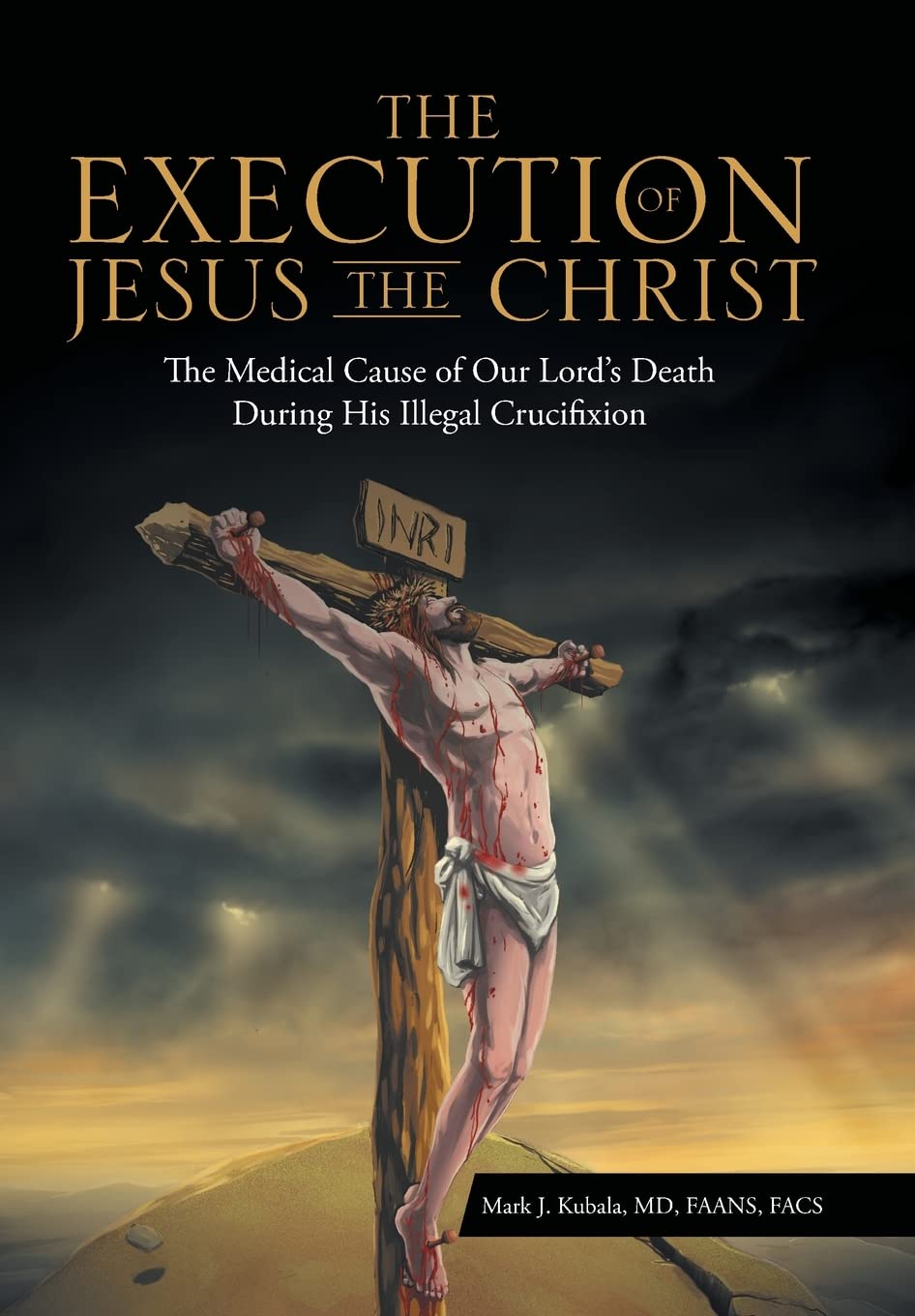 The Execution of Jesus the Christ: The Medical Cause of Our Lords Death During His Illegal Crucifixion