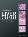 PATHOLOGY OF LIVER DISEASES (HB 2017)