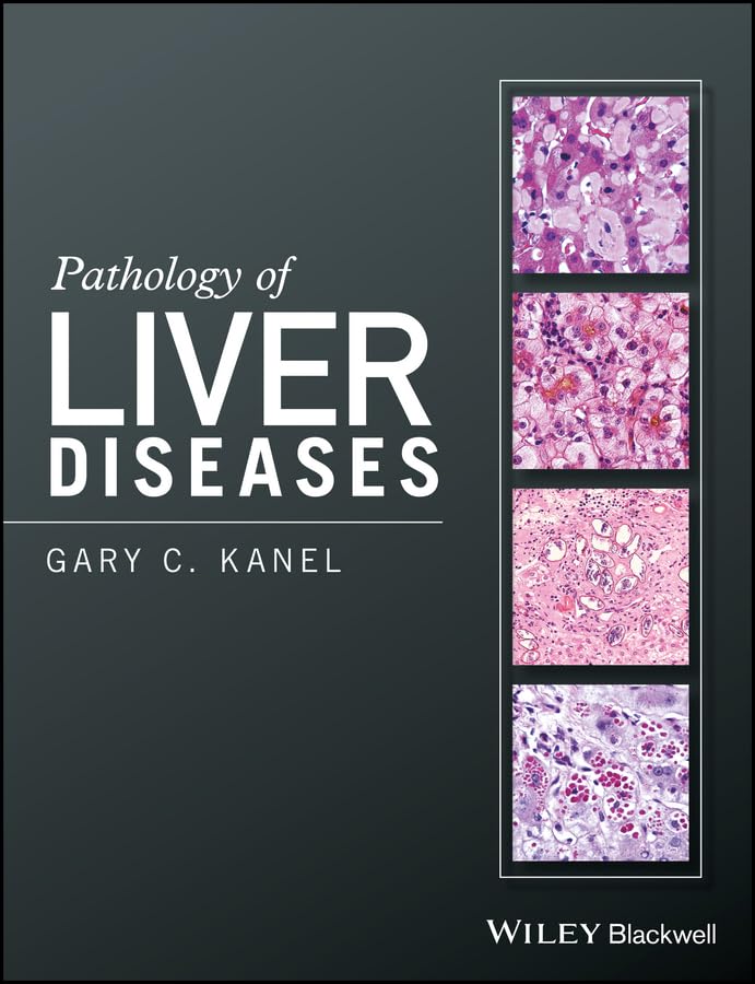PATHOLOGY OF LIVER DISEASES (HB 2017)
