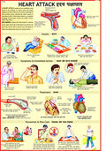 Heart Attack Chart