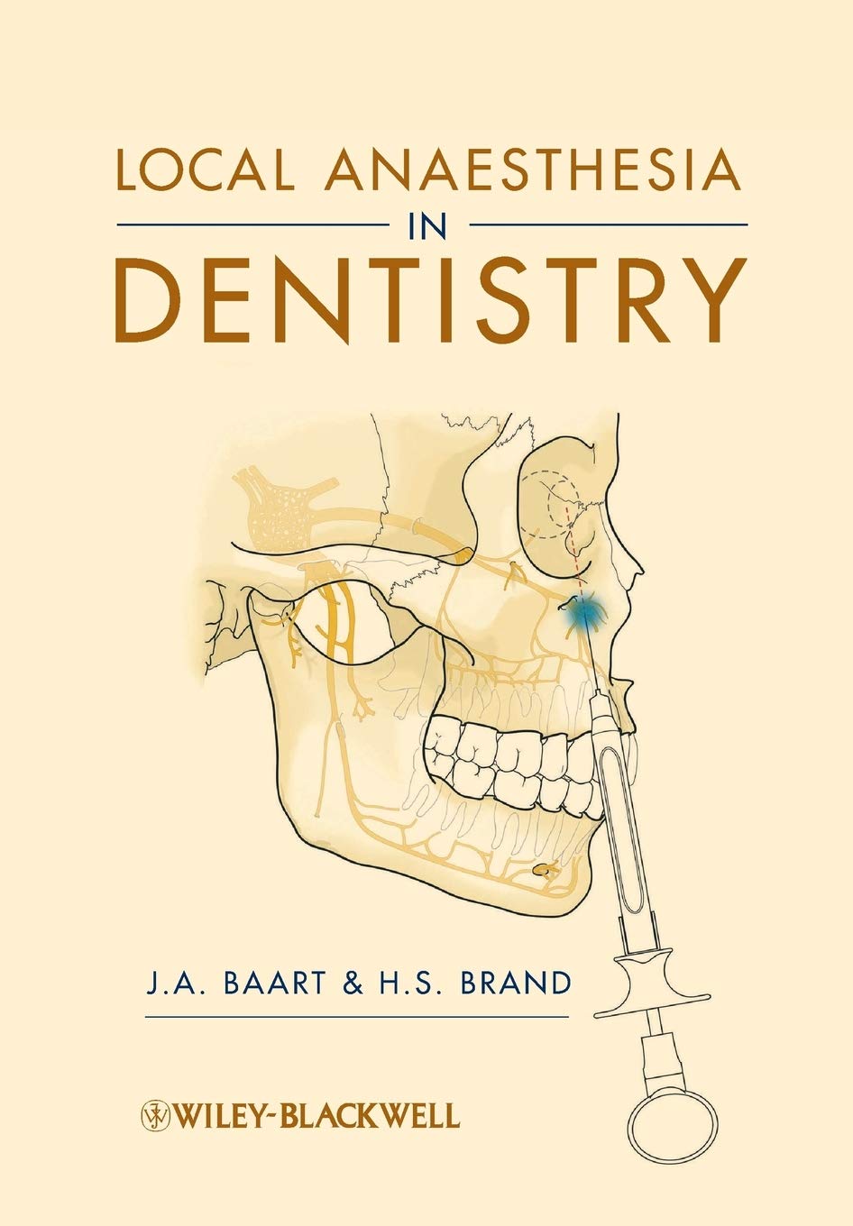Local Anaesthesia In Dentistry (Pb 2009)