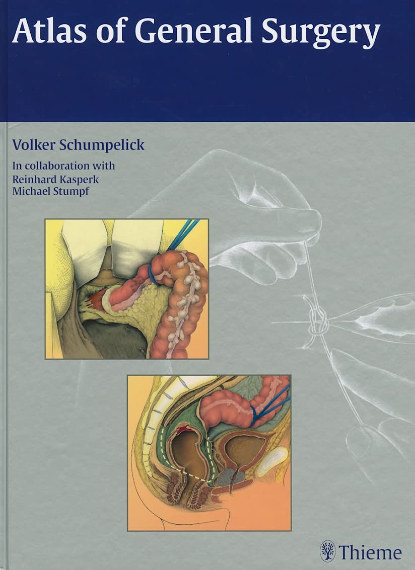 Atlas of General Surgery