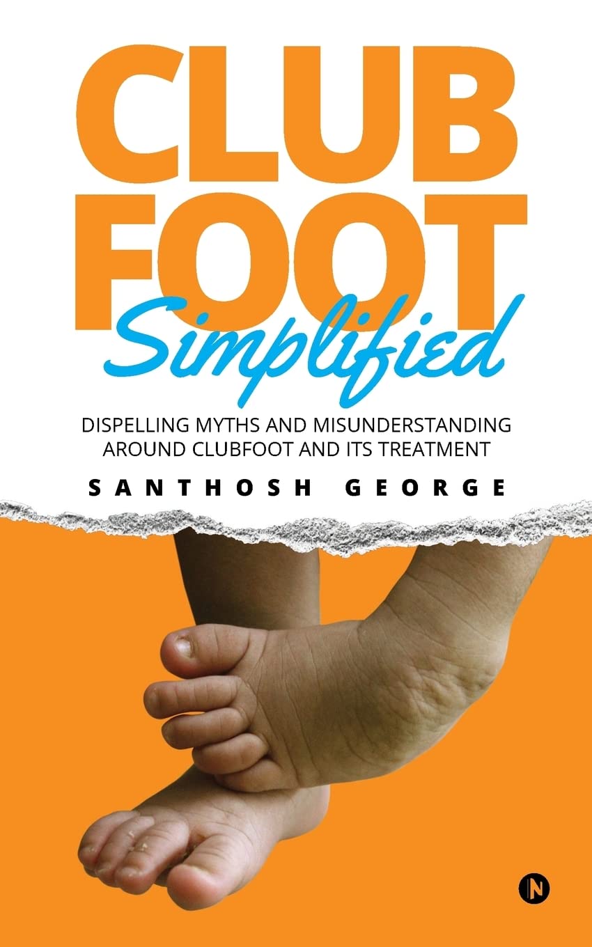 Clubfoot Simplified : Dispelling Myths and Misunderstanding around Clubfoot and its treatment
