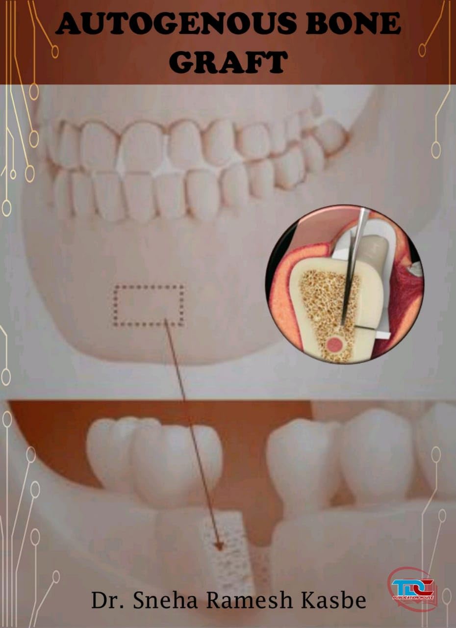 AUTOGENOUS BONE GRAFT