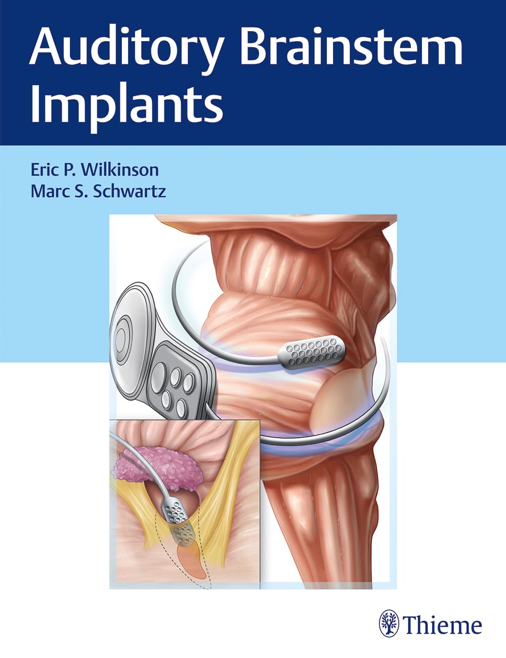 Auditory Brainstem Implants 1st Ed.