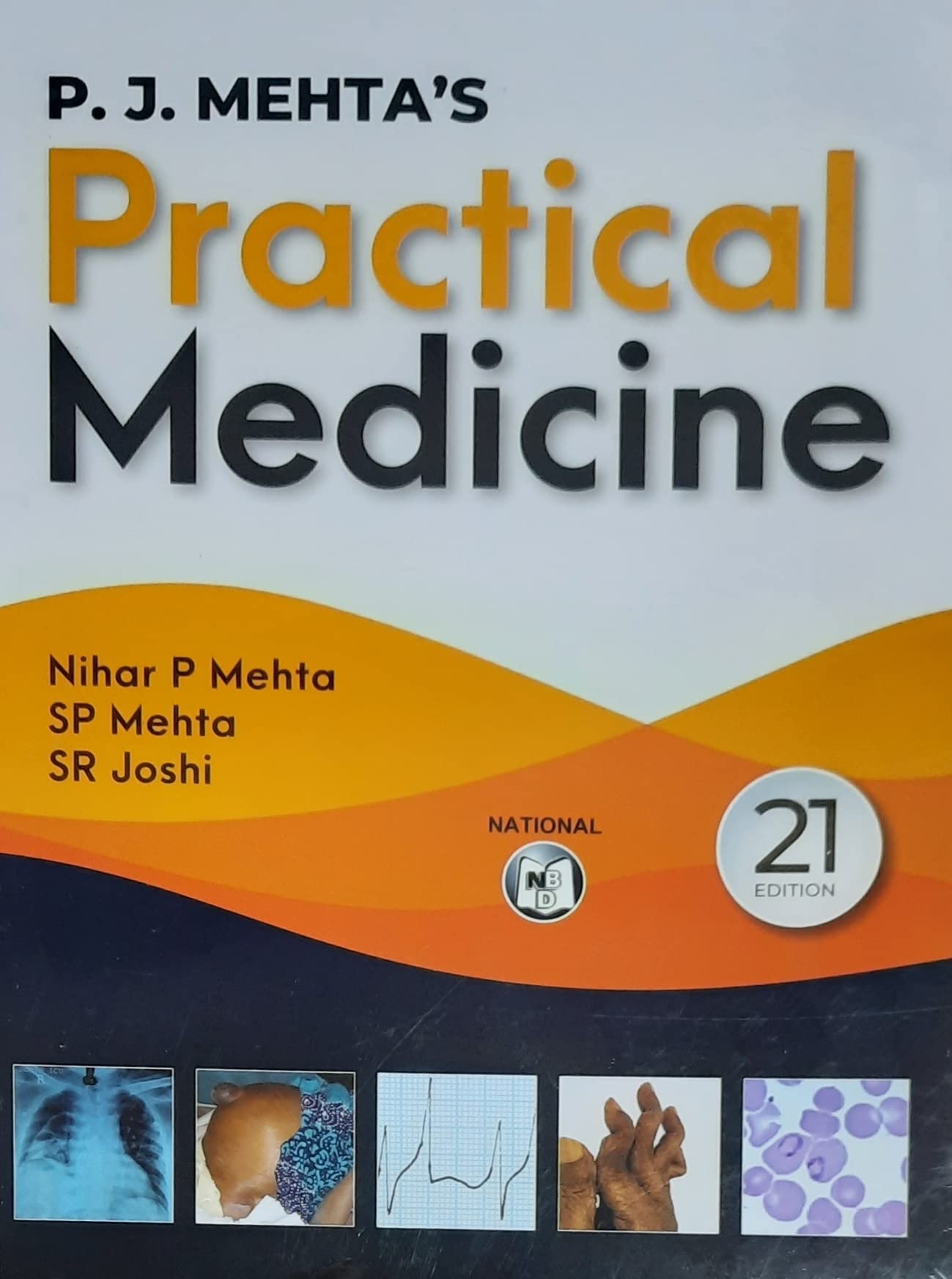 Old Edition  PRACTICAL MEDICINE 21ED