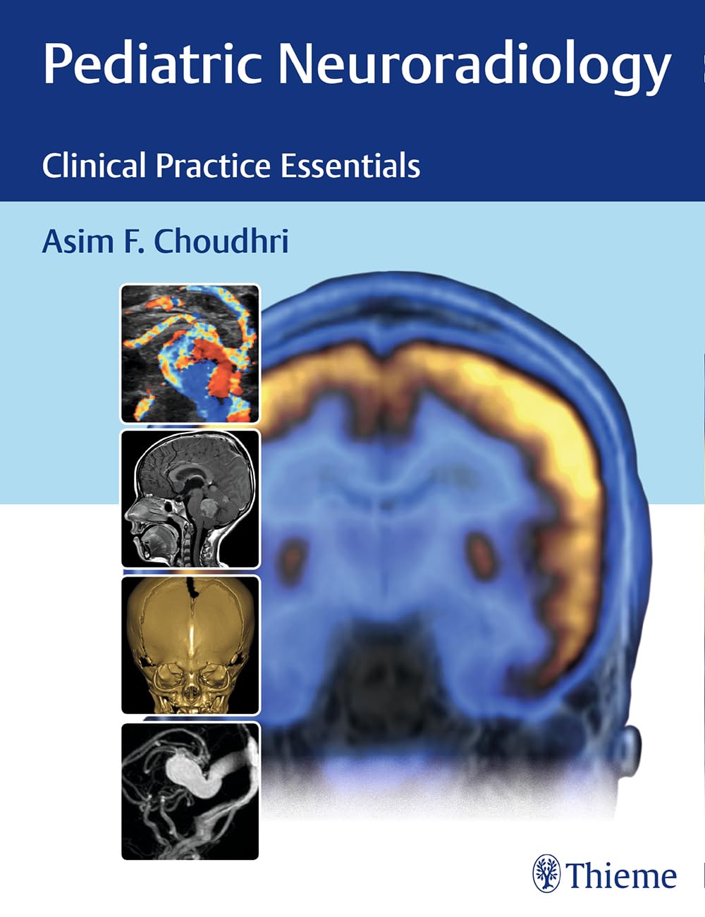 Pediatric Neuroradiology: The Essentials