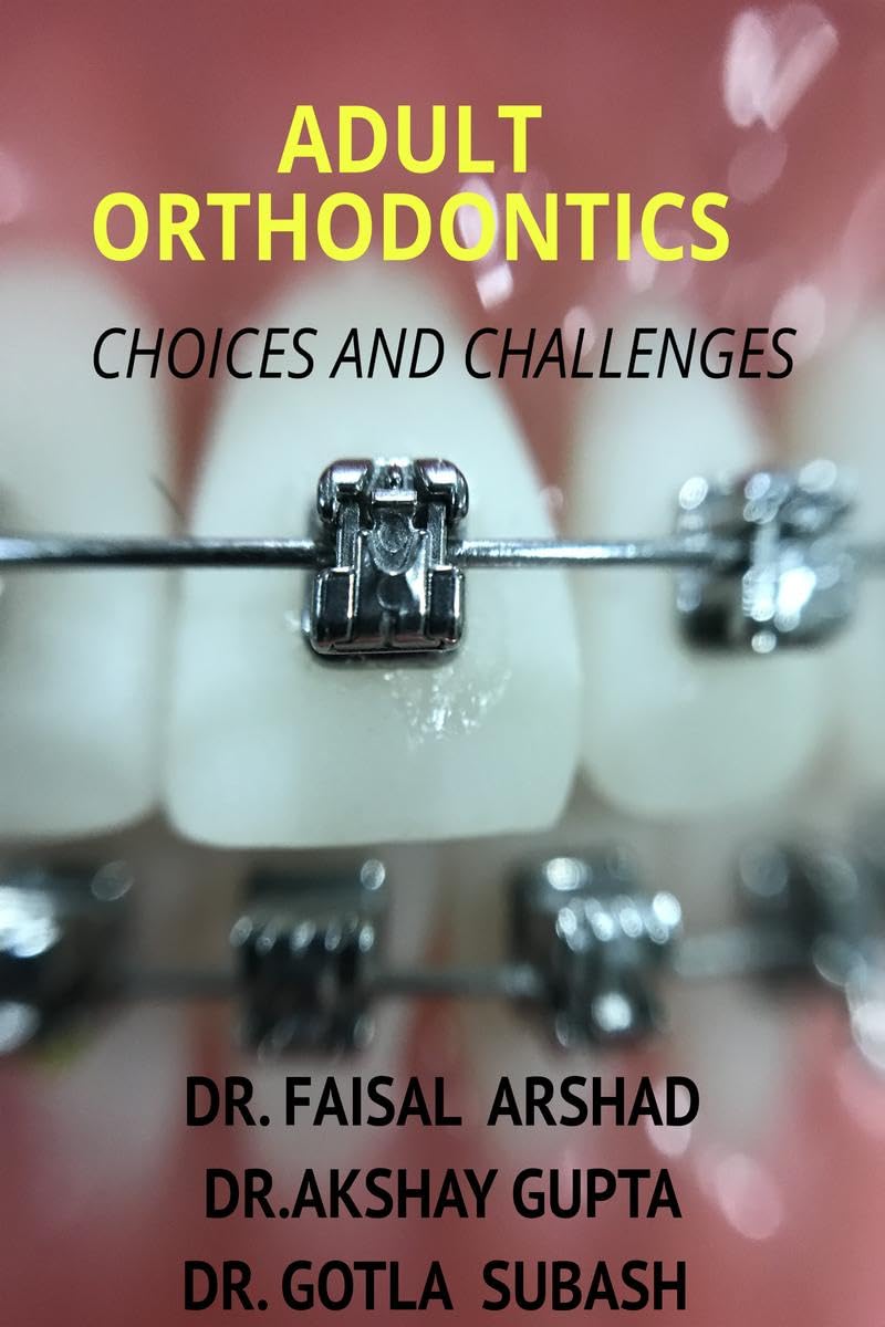 ADULT ORTHODONTICS : choices and challenges