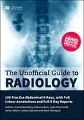 The Unofficial Guide To Radiology 100 Practice Abdominal X Rays With Full Colour Annotations And Full X Ray Reports (Pb 2020)