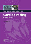 The Nuts and Bolts of Cardiac Pacing 2nd Edition by Kenny, Tom (2008) Paperback