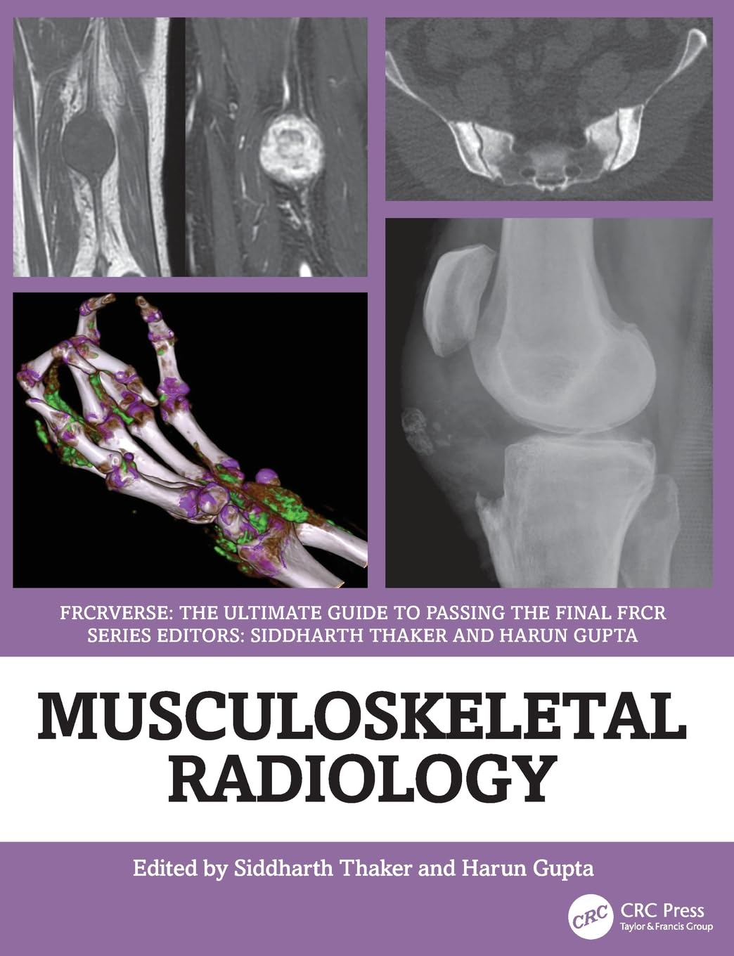 Musculoskeletal Radiology: An Ultimate Guide To Passing The Final Frcr (Frcrverse)