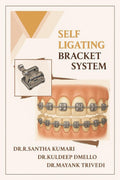 SELF LIGATING BRACKET SYSTEM