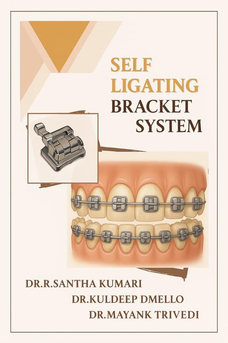 SELF LIGATING BRACKET SYSTEM