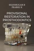 Provisional Restoration in Prosthodontics: a prep guide