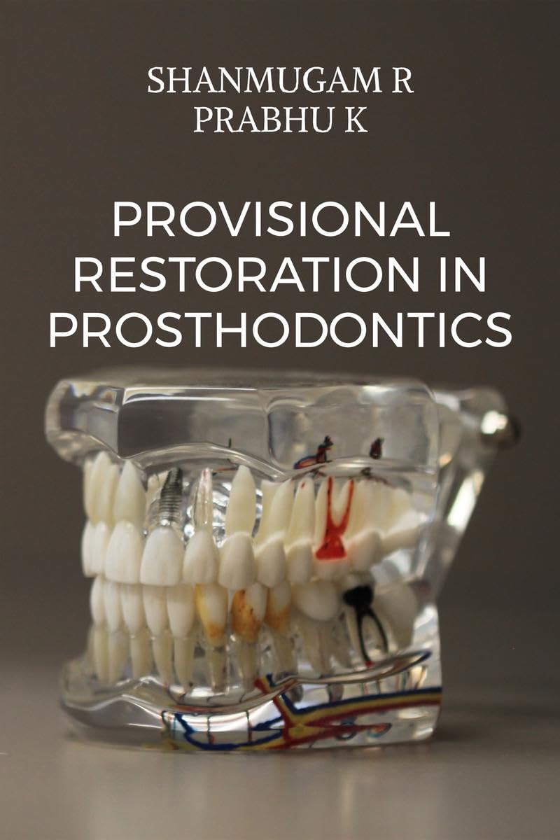 Provisional Restoration in Prosthodontics: a prep guide