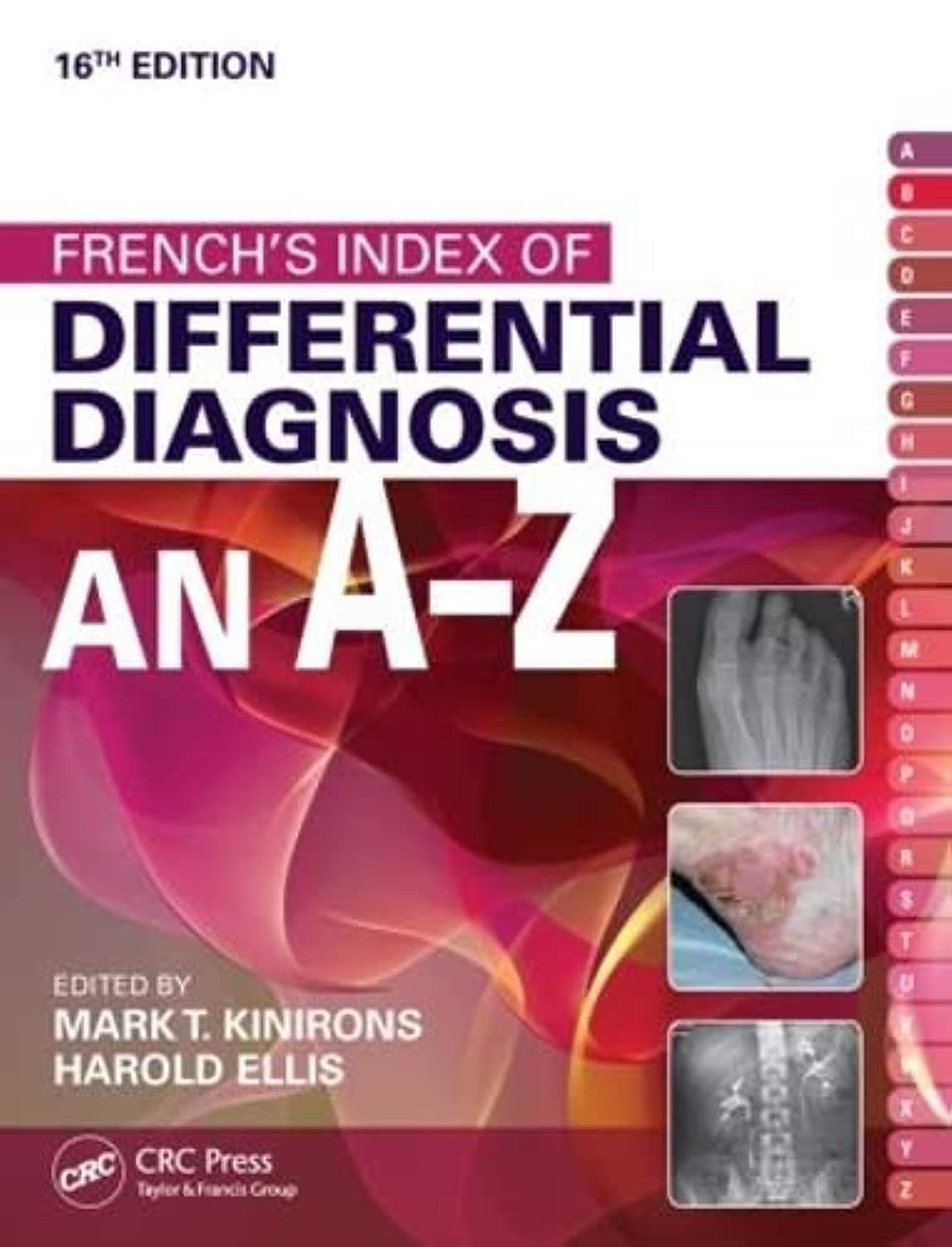 Frenchs Index of Differential Diagnosis An AZ 1