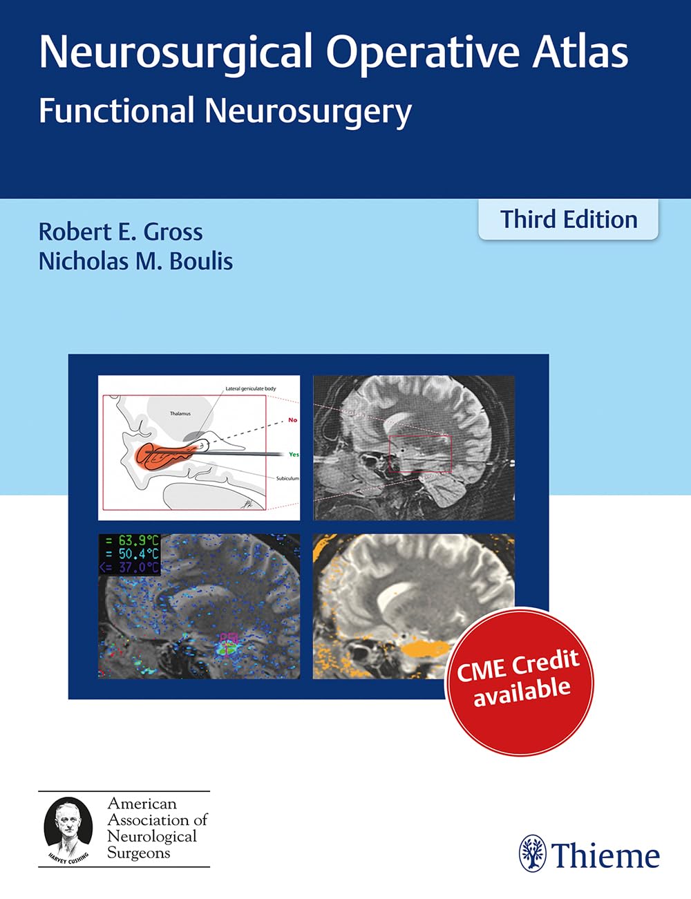 Neurosurgical Operative Atlas: Functional Neurosurgery: 3/e